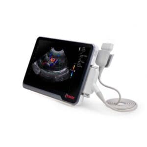 Esaote MyLab X1